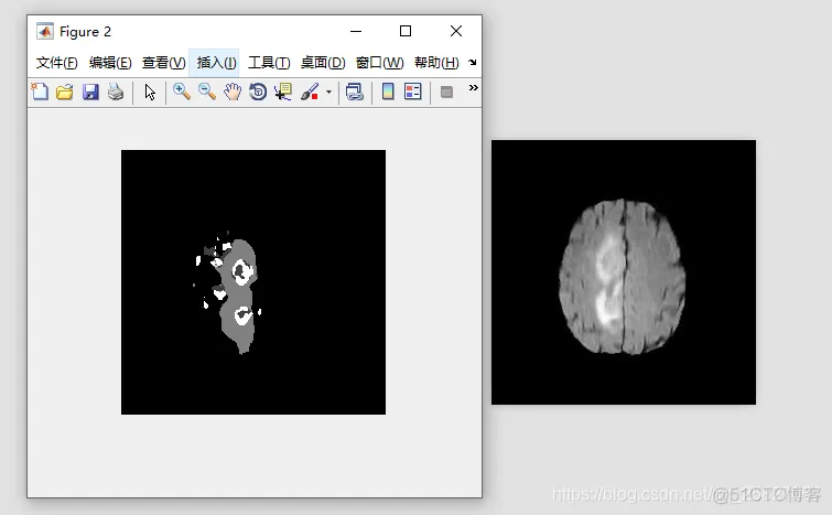 BioNLP13CG数据集 brats2019数据集_深度学习_06